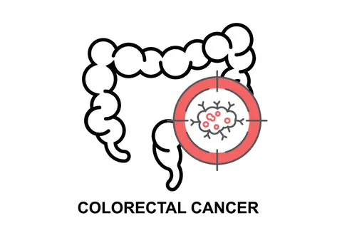 colon01
