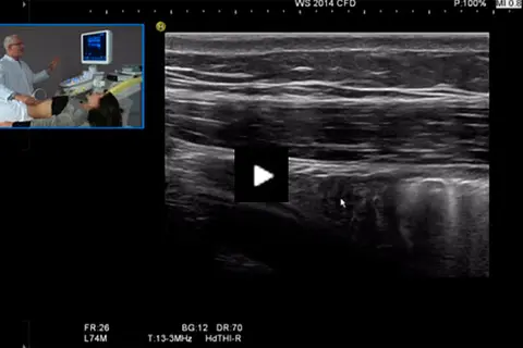 Video_course_abdominal_ultrasound