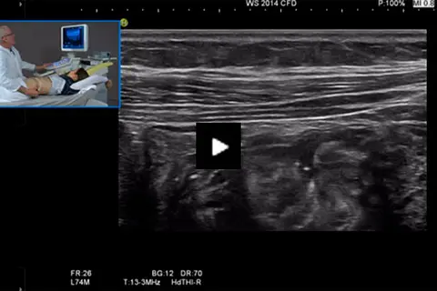 video_examination_of_the_gastrointestinal_tract