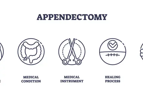 Appendectomy