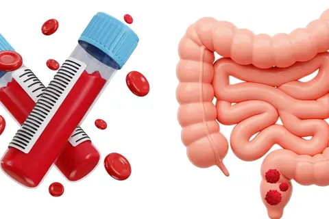blood_test