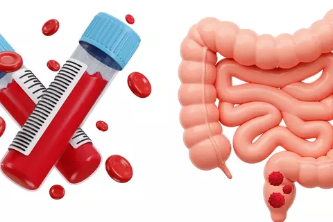 blood_test