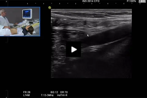 examination_gi_tract