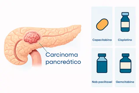 new-standard-neoadjuvant-therapy