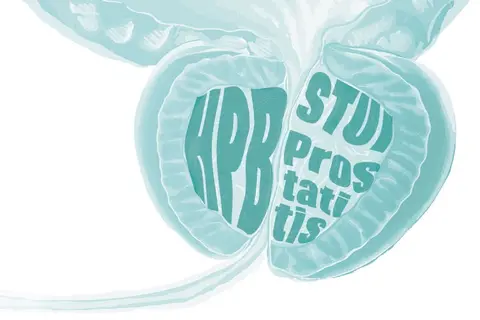 prostata-prosgutt