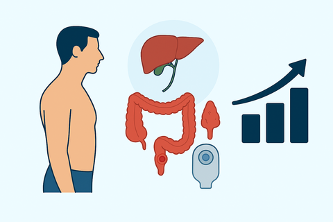 proctolectomy