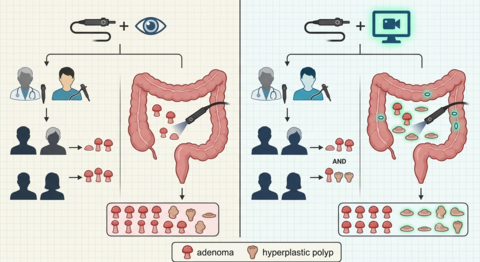 colonoscopic_adenoma_detection_cade