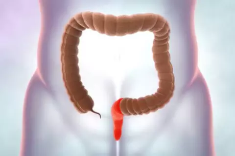 prostitis