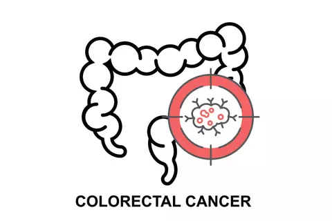 colon01