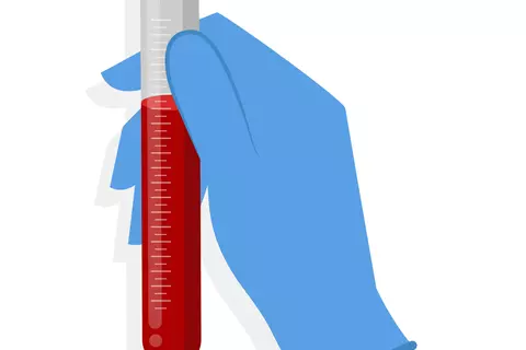 tubo_muestra_de_sangre