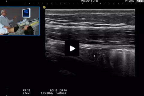Video_course_abdominal_ultrasound