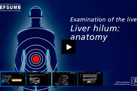 video_Examination of the liver - Liver hilum: anatomy