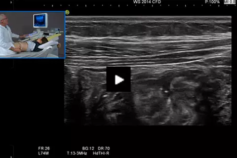 video_examination_of_the_gastrointestinal_tract