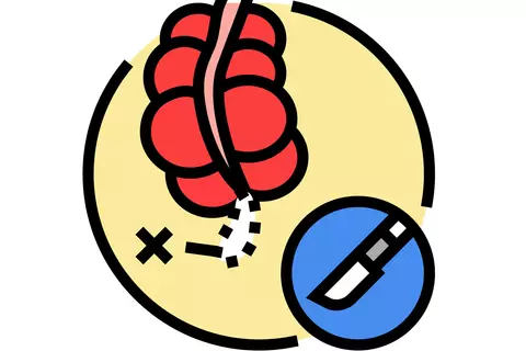 Crohn’s_disease