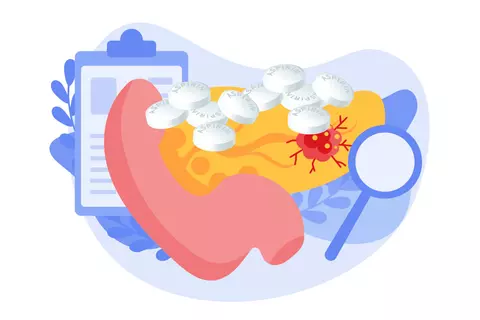 pancreatic_cancer_risk