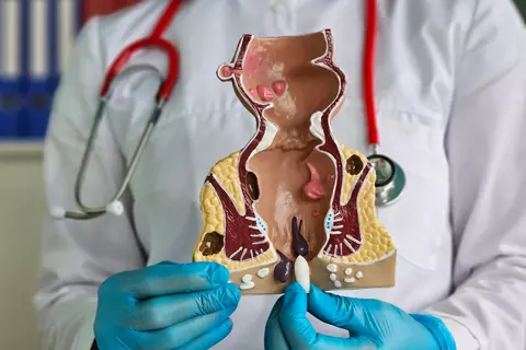 supositorio_rectal