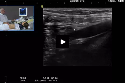 examination_gi_tract