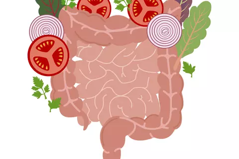 irritable_bowel_syndrome