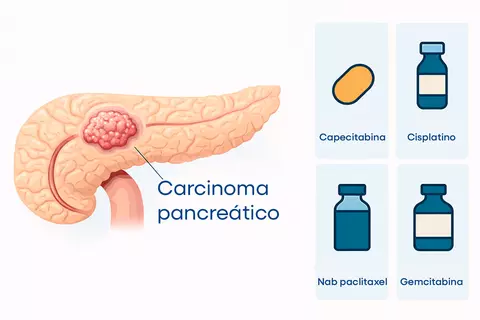 new-standard-neoadjuvant-therapy