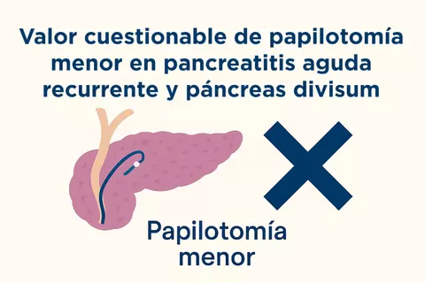 papilotomia-en-pancreatitis