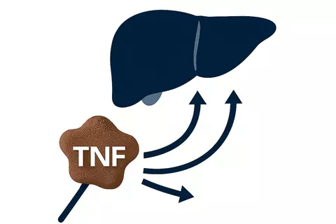 tnf_in_autoimmune_hepatitis