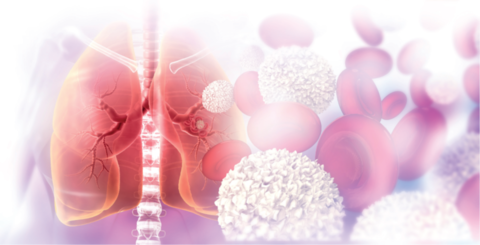 Diagrama_de_pulmones_humanos_con_virus