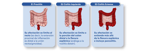 salofalk_intestinos