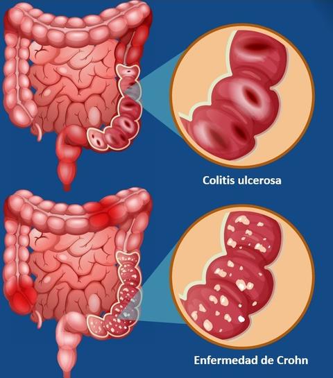 imgssalofalk_art_intestinos