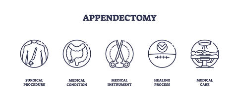 Appendectomy
