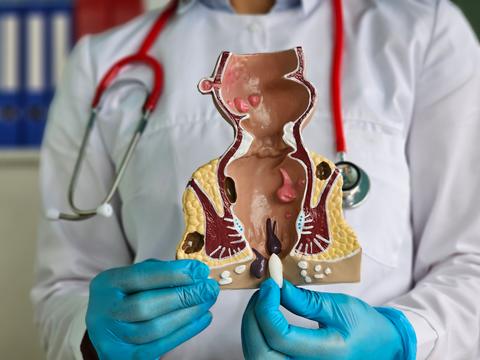 supositorio_rectal