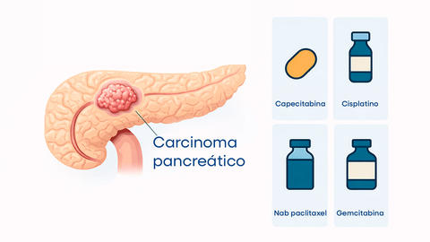 new-standard-neoadjuvant-therapy